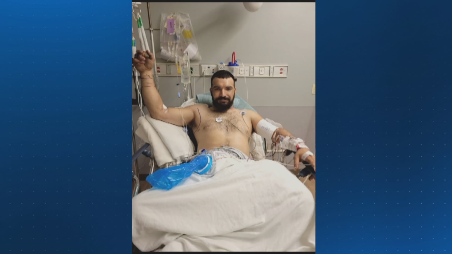 Snake Handler Bitten by Timber Rattlesnake on Mount Davis