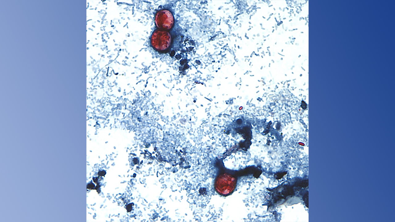 CDC Identifies Multi-State Cyclospora Outbreak Linked to Taco Bell, Taylor Farms Lettuce