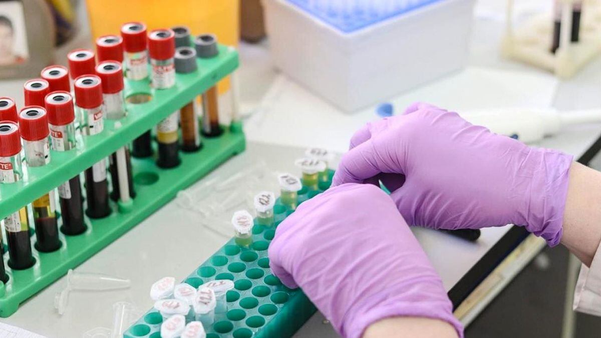 New cancer test can detect the disease in 10 minutes, researchers say